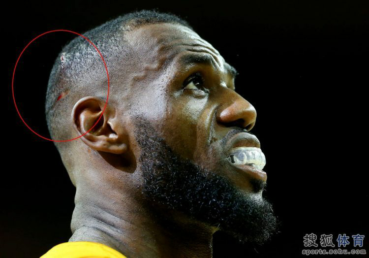 开云官网-包含转折点北京国安强势反弹克里夫兰骑士赛前完成体检，连对手都承认：塔图姆在老鹰比赛中赛事规则更新的词条